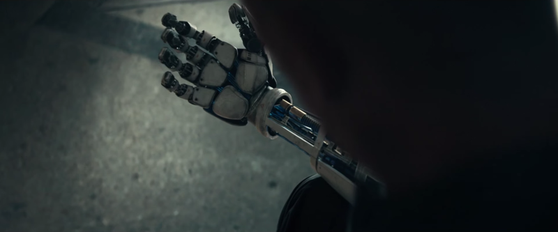 File:Prosthetic arm.png