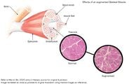 Illustration of augmented skeletal muscle.